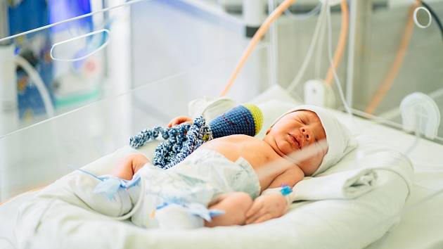 Předčasně narozené miminko potřebuje mnohdy zvláštní péči.