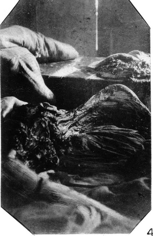 Fotografie z místa činu, znetvořené tělo Mary Jane Kellyové, páté oběti Jacka Rozparovače.