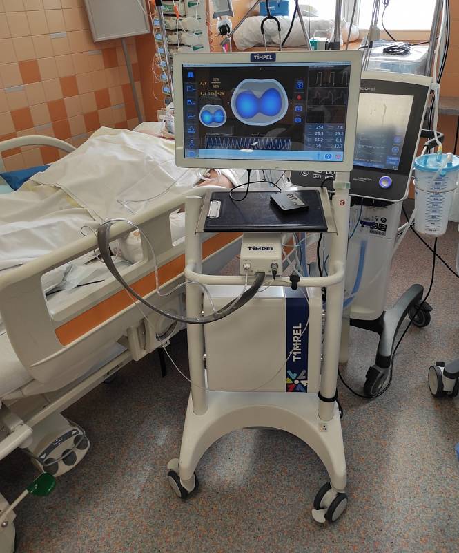 Lékaři slíbené přístroje na skenování plic, které pomohou řídit plicní ventilaci, nedostali. Čekají už od jara.