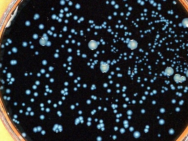 Bakterie Legionella. Ilustrační foto