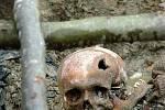 Lebka oběti masakru Srebrenica v červenci 1995. Exhumovaný hromadný hrob u obce Potočari, Bosna a Hercegovina, červenec 2007