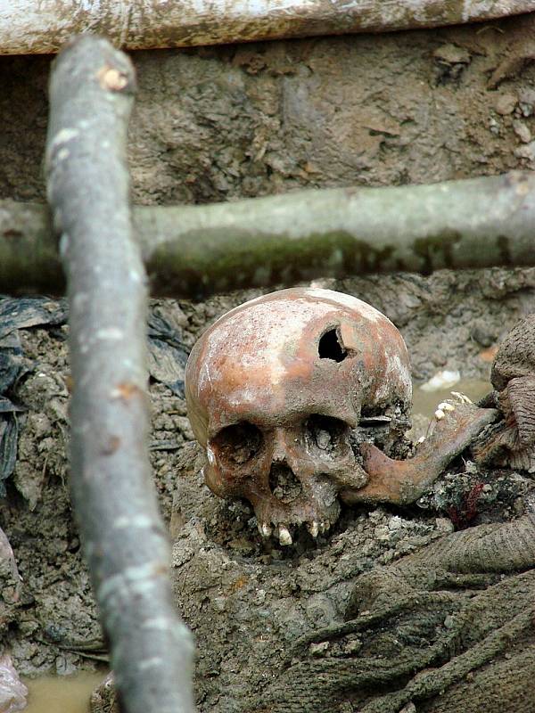 Lebka oběti masakru Srebrenica v červenci 1995. Exhumovaný hromadný hrob u obce Potočari, Bosna a Hercegovina, červenec 2007