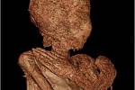 Rentgenový snímek mumie přezdívaná Záhadná dáma. V době smrti byla egyptská žena těhotná.
