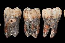 Před více než 90 lety se našel zub, jenž vypadal jako od neandertálského dítěte. Pak se ale na desítky let ztratil v soukromých sbírkách. Když se opět objevil, vzbudil senzaci