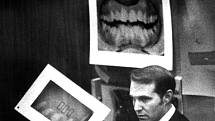 Klíčový důkaz. Soudní znalec Richard Souviron u soudu v Miami v roce 1979 ukazuje dentální záznamy vraha Teda Bundyho. Šlo o klíčový důkaz v procesu týkajícím se vražd a napadení studentek na koleji sesterství Chi Omega. Bundy totiž některé oběti pokousal