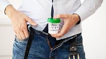 Pozitivní zprávou však je, že výrazné snížení hmotnosti vede u obézních mužů k úpravě hladiny hormonů a zlepšení hodnot spermiogramu