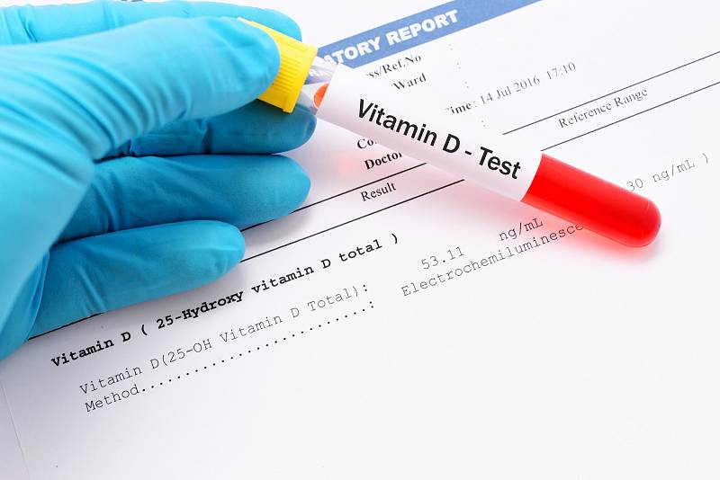 Test množství vitaminu D v krvi může předepsat lékař, nebo si ho v kterékoliv soukromé laboratoři můžete zaplatit sami