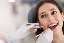 Zubní plak je schopen vytvořit kaz už během jediného dne.
