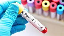 Léčba hepatitidy C je dostupná ve specializovaných centrech ČR.