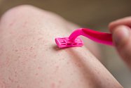 Tečky, které se objevují na nohou po holení, trápí mnoho žen.