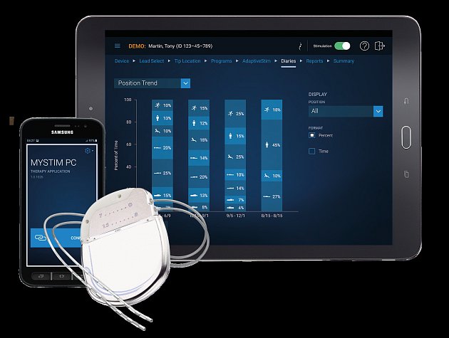 V popředí je kompletní neuromodulační zařízení, které se implantuje do těla pacienta tj. generátor, vodič a elektrody. Pomocí telefonu a tabletu se vše aktivuje a nastavuje. Telefon má po řádném zaškolení k dispozici pacient. Tablet používá ošetřující lék