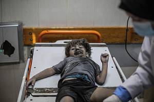 Dítě zraněné po náletu na město Khan Yunis v nemocnici Násir. Ilustrační snímek
