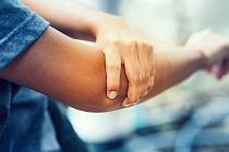 Revmatoidní artritida se obvykle objevuje mezi 40. a 60. rokem života
