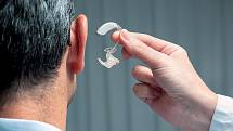 Korektivní prostředky sluchu ne každému vyhovují. Mnozí se raději smíří se sociální  izolací, než by se sžili s naslouchátkem.
