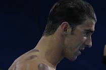 Phelpsovy záhadné skvrny způsobilo baňkování