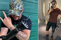 O to, aby měl pravou ruku, bojoval Lukáš Polčák dlouhých deset let. Nakonec mu k získání bionické protézy pomohla až sbírka.