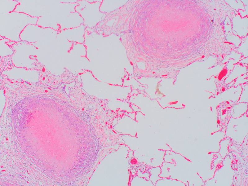 Mikroskopický snímek Pneumocystis jiroveci, houby objevené český parazitologem Otto Jírovcem