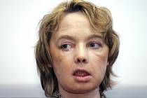 Francouzka Isabelle Dinoireová, které před 11 lety v Amiensu jako prvnímu pacientovi na světě transplantovali část tváře, zemřela.