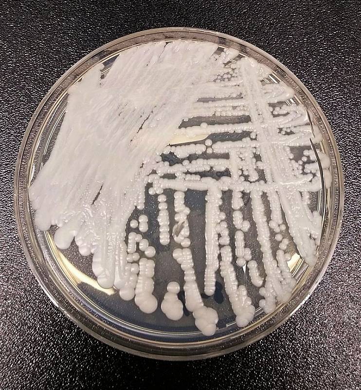 Kolonie Candida auris rostoucí v Petriho misce