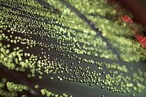 K vývoji syntetických buněk byla použita bakteriální kolonie Escherichia coli. Na snímku tato kolonie, vyrůstající v roztoku May-Grünwaldovy eosin-methylenové modři. Zelený kovový lesk je pro E. coli pěstovanou v tomto roztoku typický