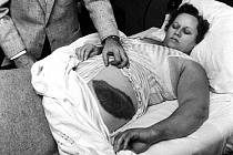 Čtyřiatřicetiletá Ann Elizabeth Fowler Hodgesová v nemocnici, kde se zotavovala po zásahu meteoritem