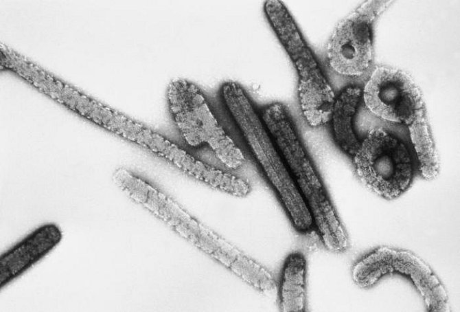 Virus marburgské nemoci zvětšený asi stotisíckrát pod elektronovým mikroskopem