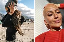 Když alopecie zaútočila, Bára byla v šoku. Do dvou týdnů přišla o všechny vlasy i chlupy
