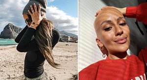Když alopecie zaútočila, Bára byla v šoku. Do dvou týdnů přišla o všechny vlasy i chlupy