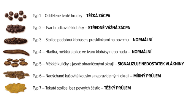 Pohled do záchodu může odhalit rakovinu. Prozradí ji barva nebo zápach  stolice - Deník.cz