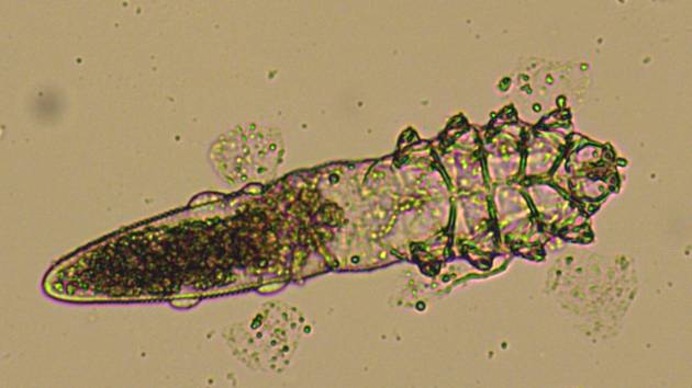 Roztoči Demodex follicularum se přes den živí mastnými kožními sekrety na obličeji člověka. V noci pak souloží a kladou vajíčka do folikul.