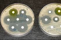 Jeden z testů rezistence na antibiotika. Candida auris patří bohužel k multirezistentním, ilustrační foto