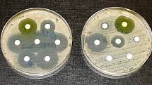 Jeden z testů rezistence na antibiotika. Candida auris patří bohužel k multirezistentním. Ilustrační snímek