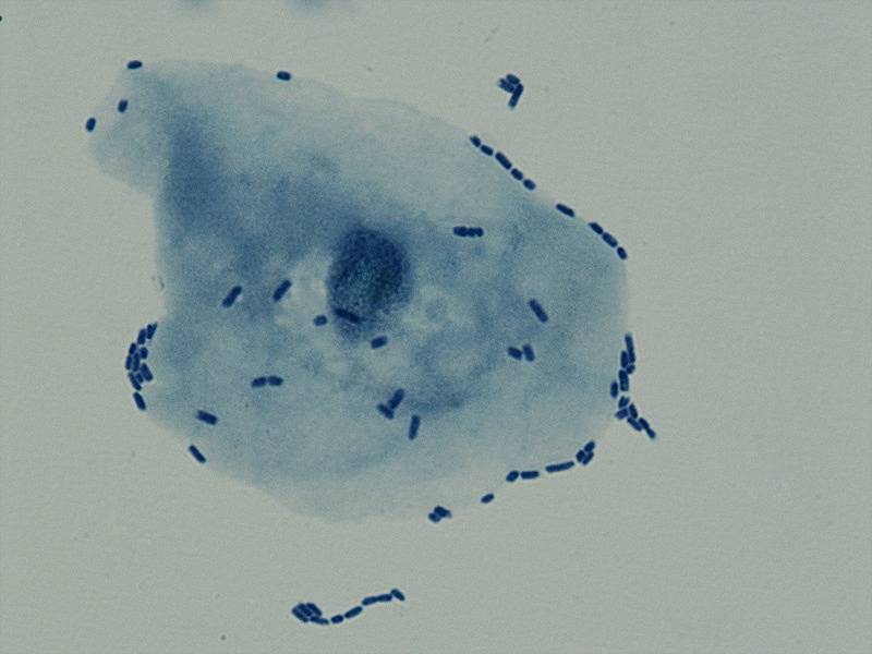 Buňky Escherichia coli přilnuly k výstelce močového měchýře - pod mikroskopem, obarveno.