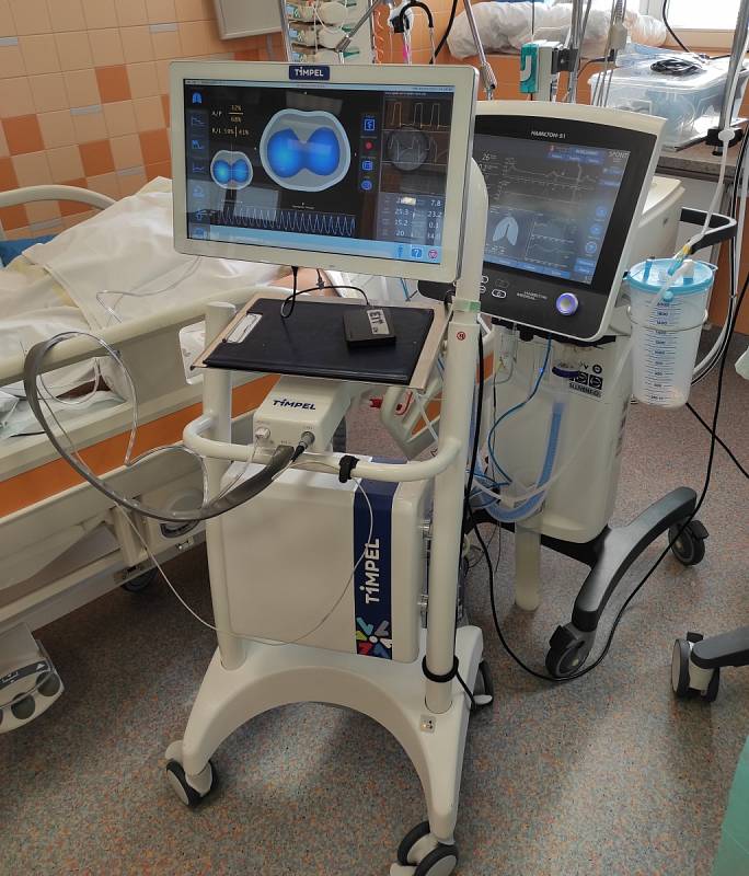 Lékaři slíbené přístroje na skenování plic, které pomohou řídit plicní ventilaci, nedostali. Čekají už od jara.
