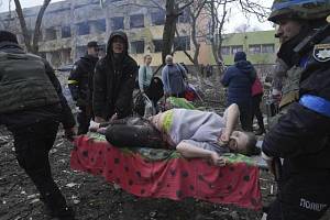 Irina Kalininová. Zraněná těhotná žena po bombardování porodnice v ukrajinském Mariupolu. Lékaři nedokázali zachránit dítě, ani ji.