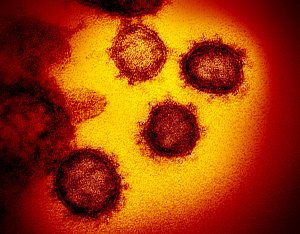 Nový koronavirus SARS-CoV-2 na nedatovaném snímku z elektronového mikroskopu, který v únoru 2020 zpřístupnil Americký Národní institut zdraví. Virus dříve označovaný jako 2019-nCoV způsobuje COVID-19. Vzorek byl izolován od pacienta v USA.
