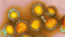 Chřipkový virus H3N2 na uměle zbarveném snímku z transmisního elektronového mikroskopu