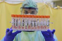 Zdravotnice se vzorky k testování na nákazu koronavirem