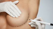 Silikonové implantáty mohou ženě zvednou sebevědomí.