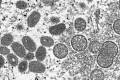 Částice viru opičích neštovic na snímku z elektronového mikroskopu z roku 2003.