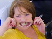 Angie Barlowová se tak bála zubaře, že si svůj chrup spravovala sama. Sloužilo jí k tomu vteřinové lepidlo.