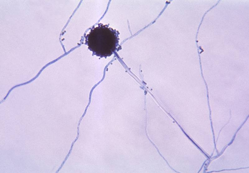 Mikroskopický snímek houby Aspergillus