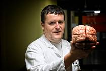 Prof. MUDr. Jakub Hort, Ph.D. působí jako vedoucí lékař kognitivního centra Neurologické kliniky 2. lékařské fakulty Univerzity Karlovy a Fakultní nemocnice Motol v Praze.