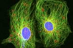 Rakovinné buňky s průměrem okrouhlých jader asi 12 mikrometrů ve speciálním mikroskopu na zkoumání živých buněk. Ilustrační snímek