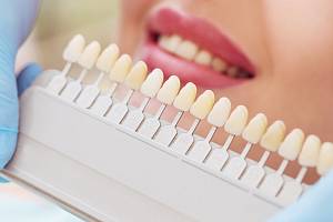Podle aktuálních výsledků průzkumu skupiny Labs1503 je s vyrovnaností a pravidelností svých zubů spokojeno pouhých osmatřicet procent Čechů