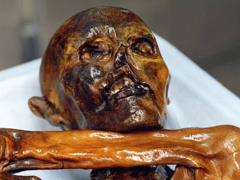 Pravěký muž Ötzi, jehož mimořádně dobře zachované tělo bylo nalezeno před 25 lety v alpském ledovci na pomezí Rakouska a Itálie, trpěl nesnášenlivostí mléčného cukru, laktózy, a měl problémy s krevním oběhem.