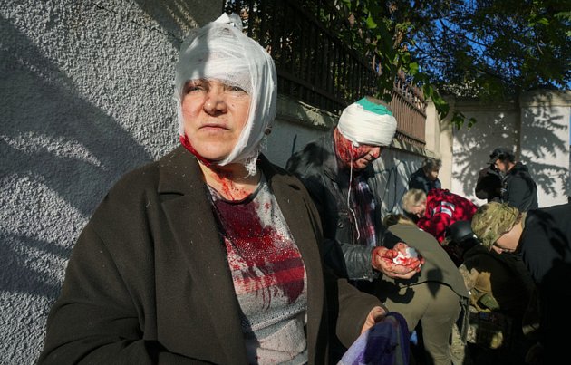 Lidé zranění během ruského raketového útoku na Kyjev, 10. října 2022.
