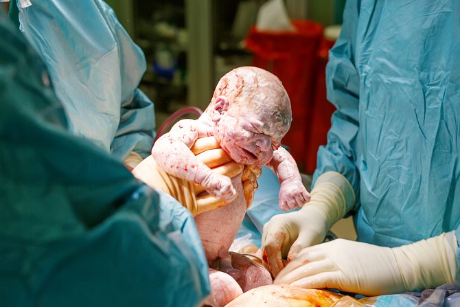 Císařský řez je velká břišní operace, při které musí operatér prořezat celkem sedm vrstev tkání. Může být plánovaný, nebo také akutní. Lékaři v některých českých porodnicích jej však dělají jinak. Laskavě, s něhou a ohledem na prožitek matky.