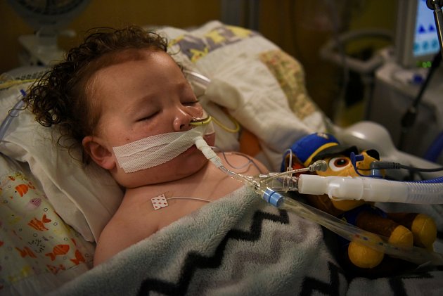 Dítě na ventilátoru, 5. října 2021. Covid si nevybírá. Na snímku je dvouletý Američan Adrian James, který byl pozitivně testován na koronavirus. Na ventilátor byl připojen v dětské nemocnici v St. Louis. O týden později byl už naštěstí doma u rodičů