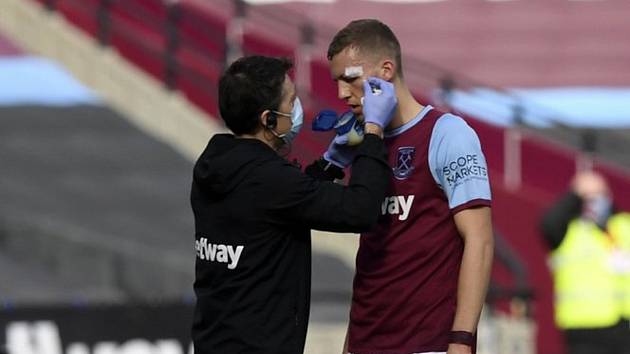 Zraněný fotbalista West Hamu Tomáš Souček se nechává ošetřit.